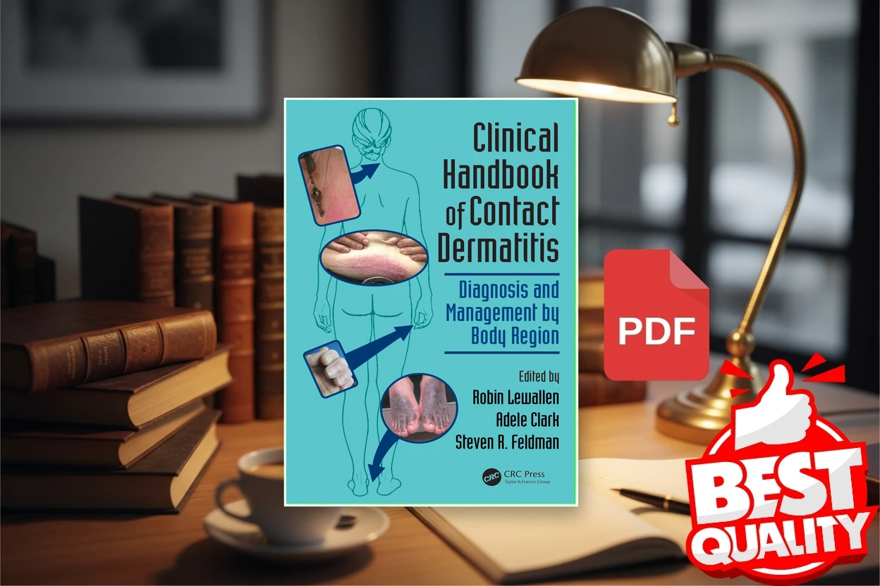 Cover for Clinical Handbook of Contact Dermatitis Diagnosis and Management by Body Region (Robin Lewallen, Adele Clark, Steven R. Feldman)